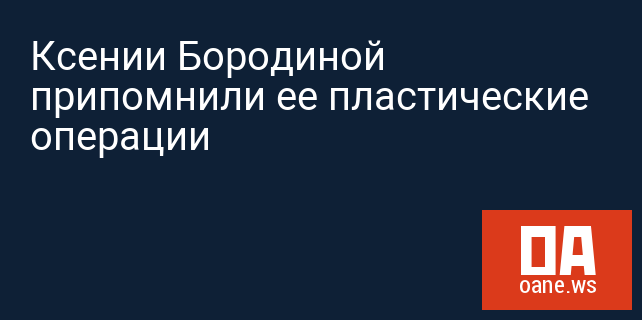 Ксении Бородиной припомнили ее пластические операции