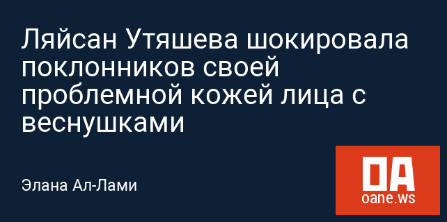 Ляйсан Утяшева шокировала поклонников своей проблемной кожей лица с веснушками