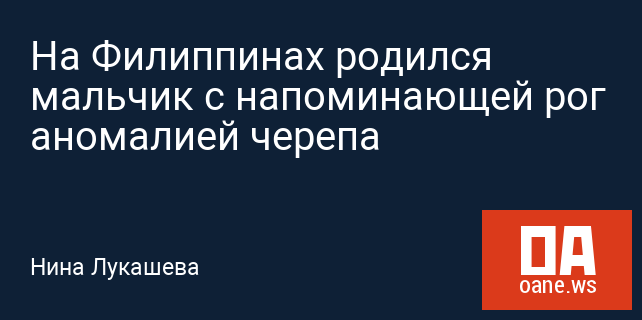 На Филиппинах родился мальчик с напоминающей рог аномалией черепа На Филиппинах родился мальчик с напоминающей рог аномалией черепа