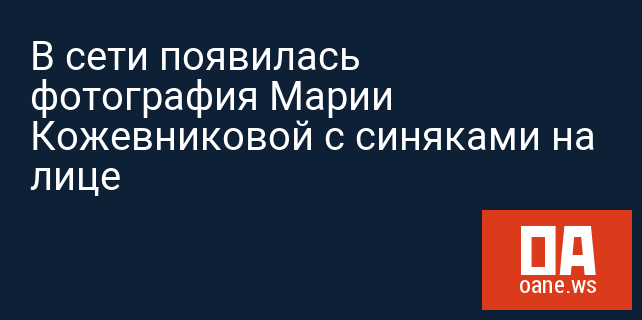 В сети появилась фотография Марии Кожевниковой с синяками на лице