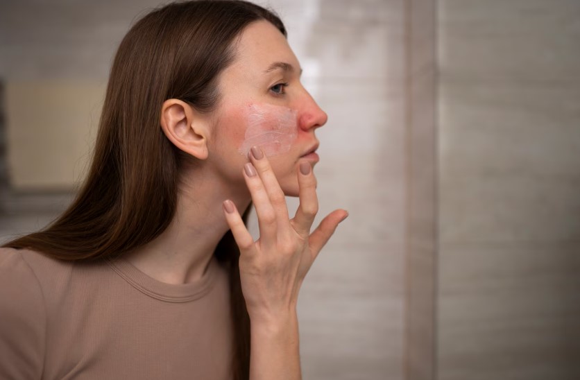 Косметологи назвали главные угрозы для кожи в зимний период